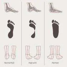 Diagram of foot arch variations