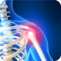 Illustration of shoulder pain in skeleton