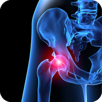 X-ray of hip joint with pain