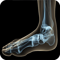Medical X-ray of foot anatomy