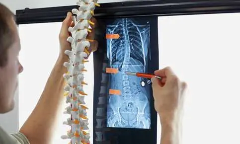 Medical professional reviewing X-ray film