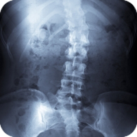 Spinal X-ray image