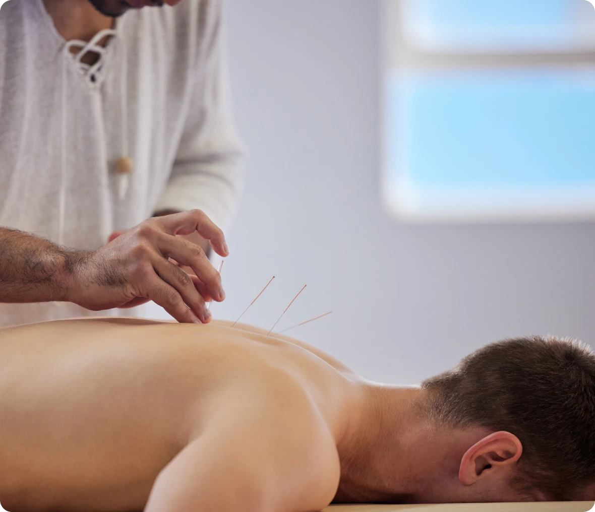 Man receiving acupuncture treatment in spa.