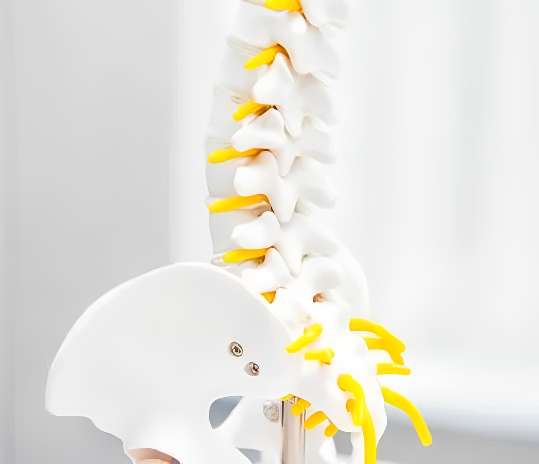 Spine model with yellow nerves