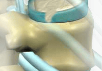 Spinal anatomy with focus on vertebra