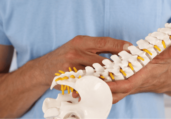 Doctor holding spine model