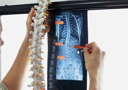 Medical professional reviewing X-ray film