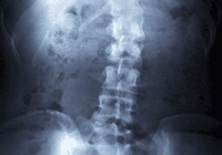 Spinal X-ray image